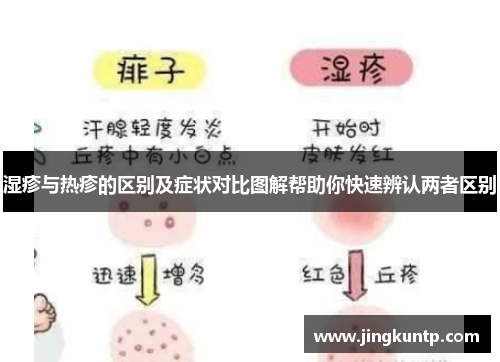 湿疹与热疹的区别及症状对比图解帮助你快速辨认两者区别 湿疹与热疹的区别及症状对比图解帮助你快速辨认两者区别